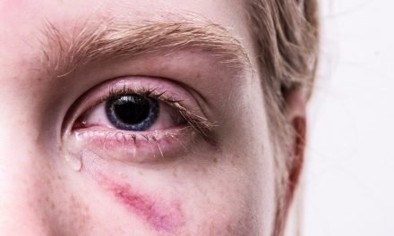 Uma pulga atrás da orelha